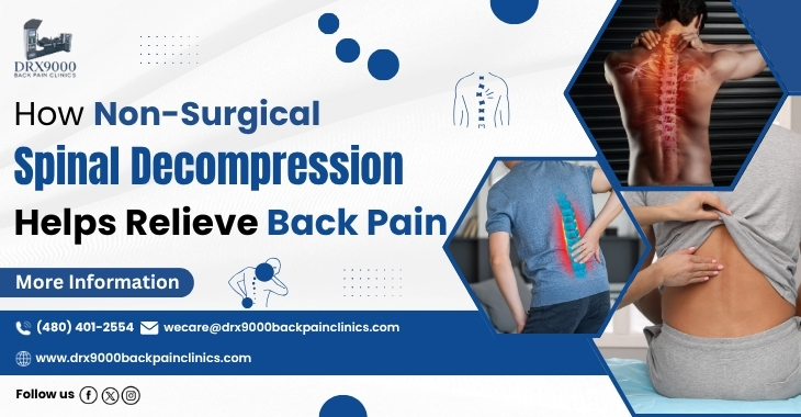 How Non-Surgical Spinal Decompression Helps Relieve Back Pain